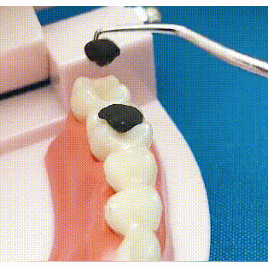  Edelstahl Zahnstocher Set | Hygienisch & Langlebig 